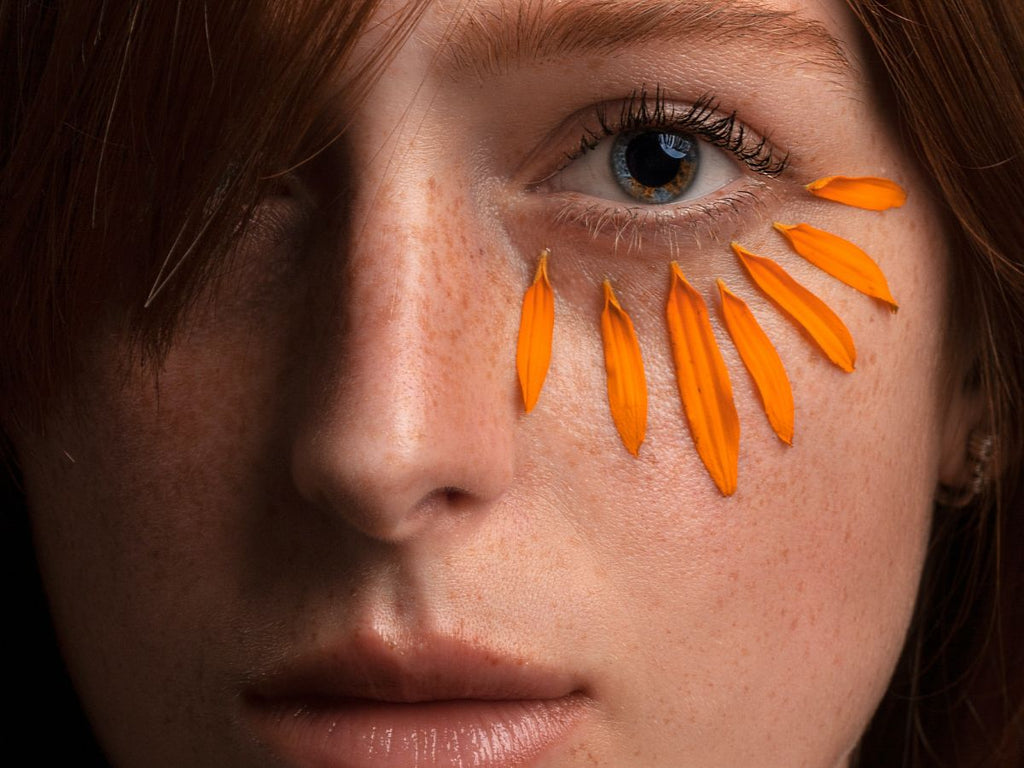 Tear Trough Filler: What, How And Examples
